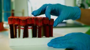 Forensic Pathology